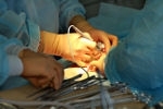 Chirurgie de l’obésité Nissen sleeve: comment une patiente a été prise en charge à Namur