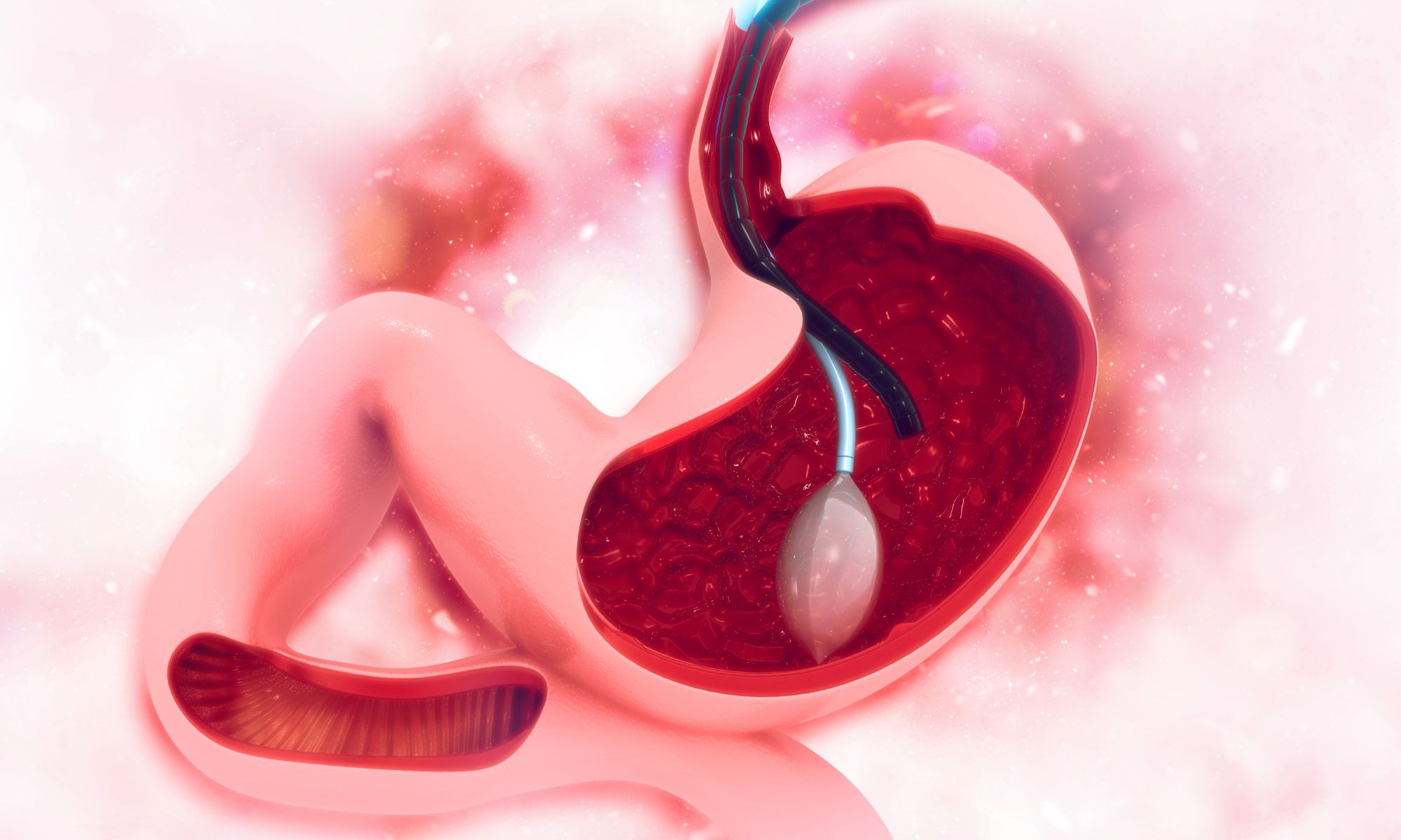 Ozempic et perte de poids : ce médicament est-il un bon moyen de lutter contre l’obésité ?