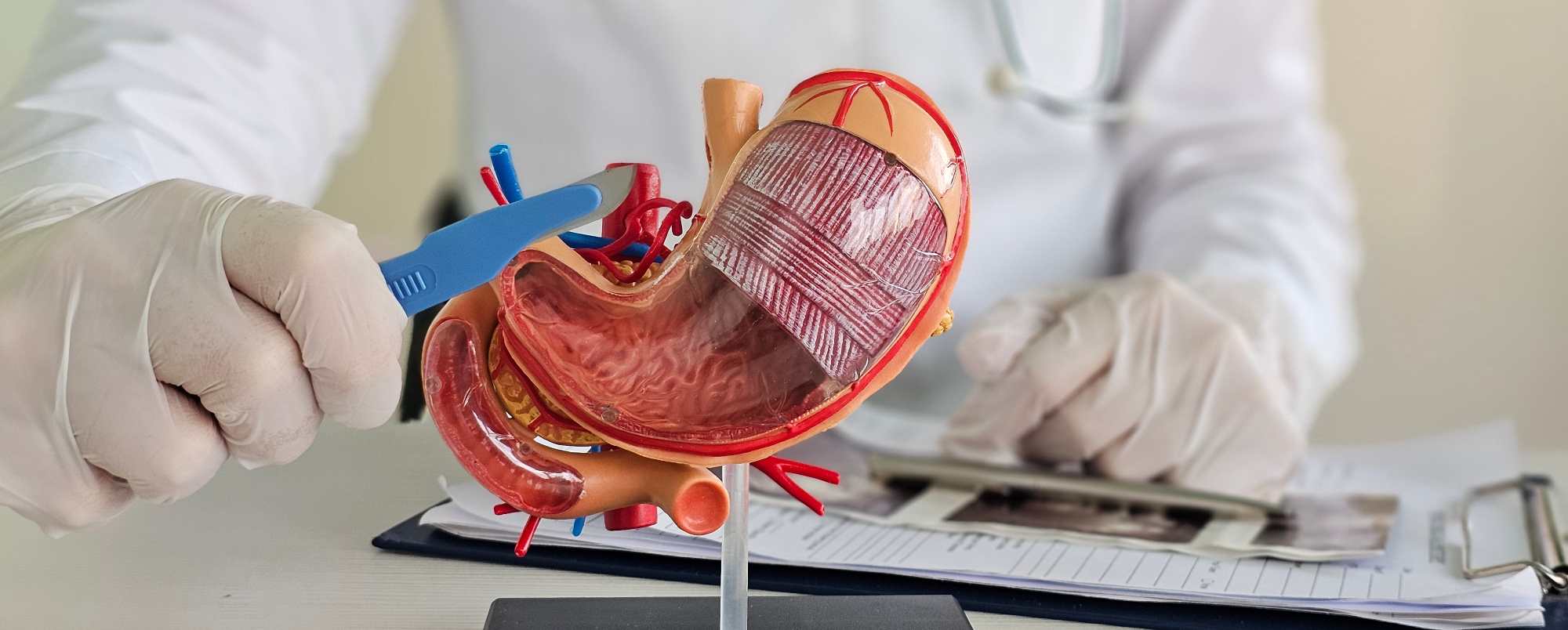 Ozempic et perte de poids : ce médicament est-il un bon moyen de lutter contre l’obésité ?